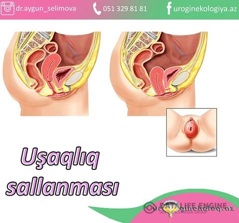 Semiz qizning eshagida