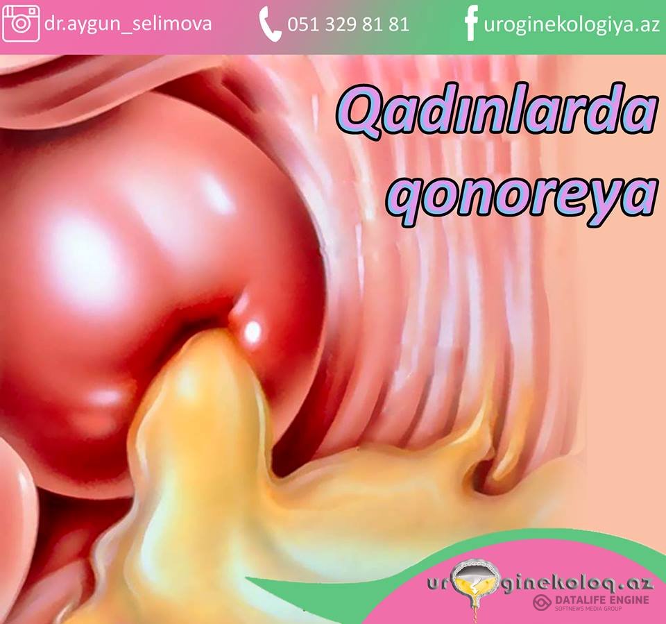 Novopavlovsk seks porno videolar Akamning xotini bilan porno onlayn